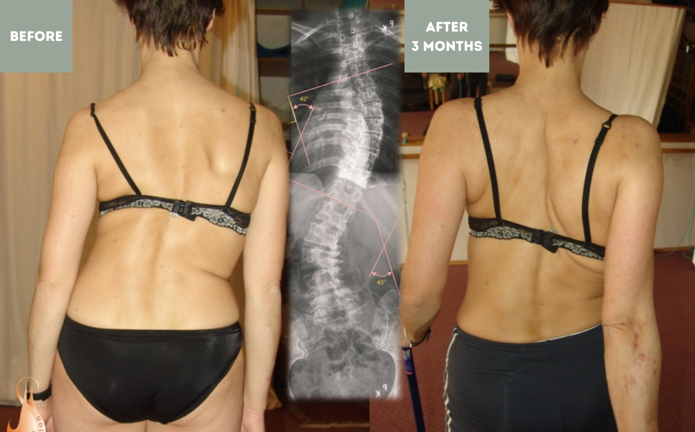 Spiral Stabilization